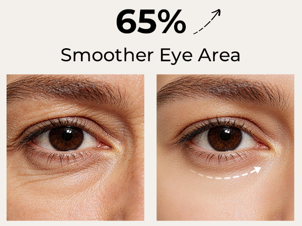 eye massager