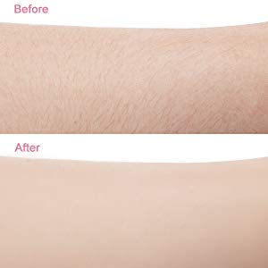 Bikini trim attachment