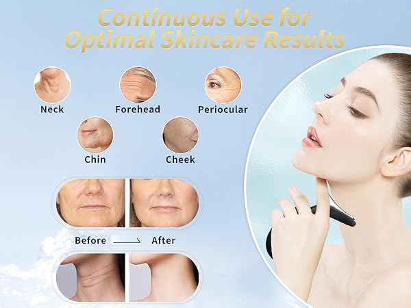 Face Massager