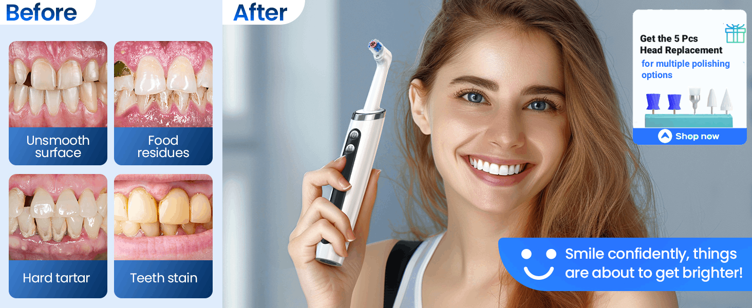 teeth stain remover