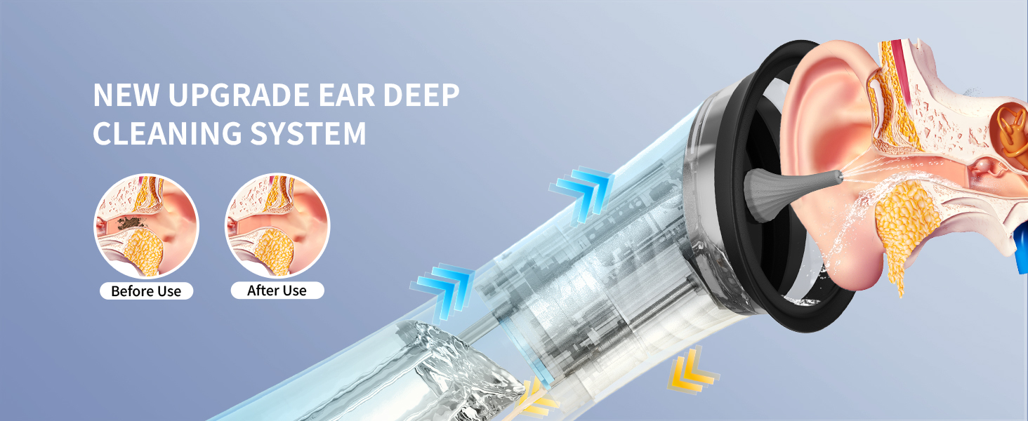 ear cleaner
