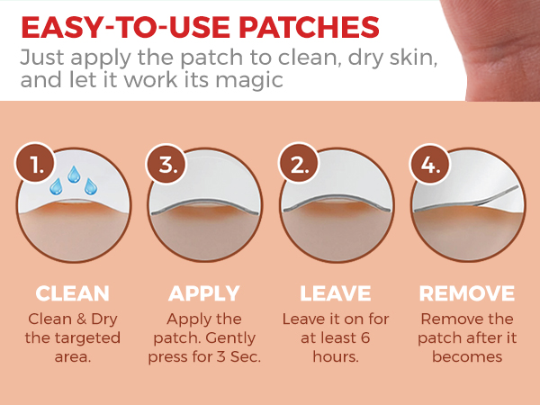 star face pimple patches, zit patches for face, acne patches for face, hydrocolloid pimple patches