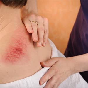 Allshow gua sha tools