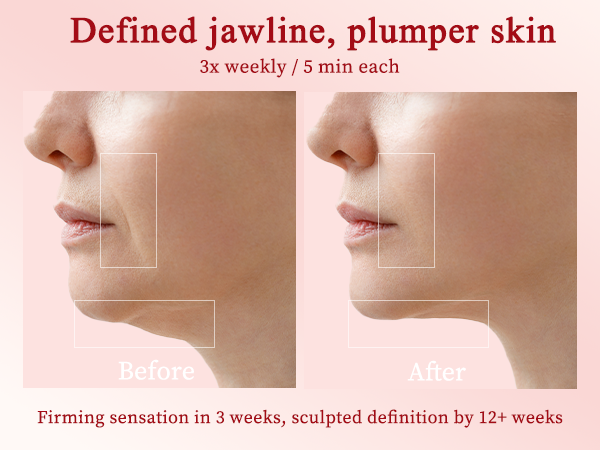 Home RF Skin Tightening Face Machine