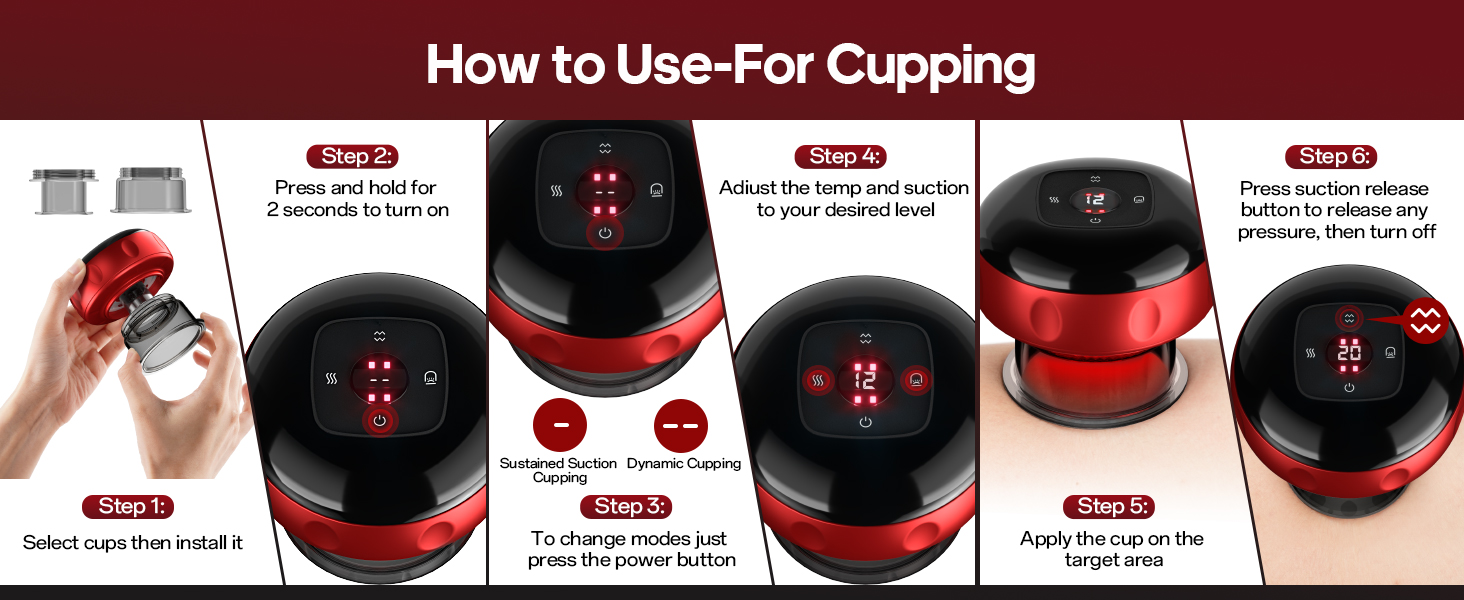 cupping