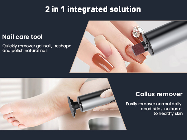 calloused feet remover tool