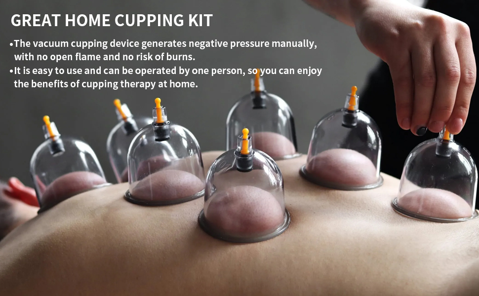 Chinese cupping set