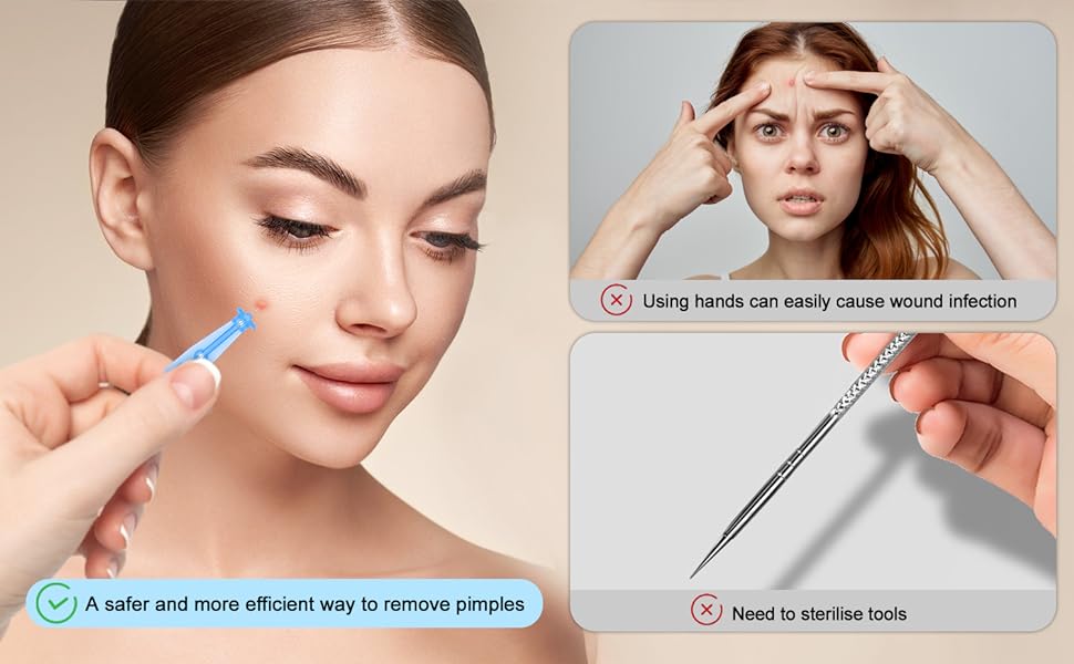 Disposable Acne Pimple Popper Needles