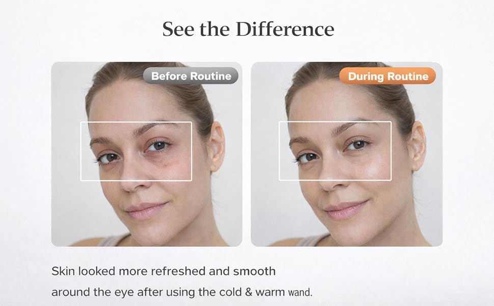 2-in-1 Cold &amp;amp; Warm Depuffing Wand -04