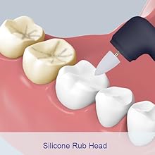 Tooth Polisher