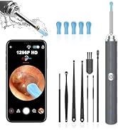 Ear Wax Removal Tool Camera, (1296P) Ear Cleaner with Light and Camera Ear Wax Cleaner with 8pcs ...
