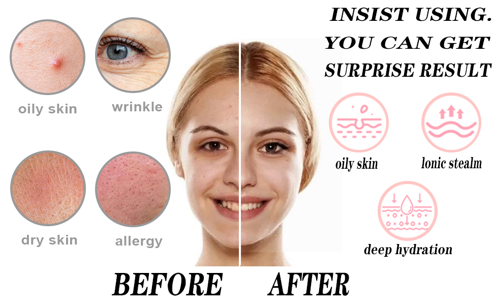 facial massager tool t shape