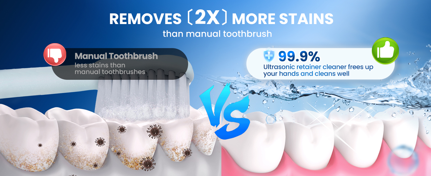 ultrasonic retainer cleaner