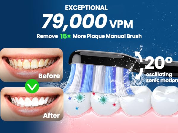 Marlincare electric toothbrush