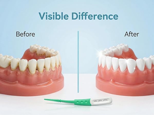 Interdental Brushes-wt