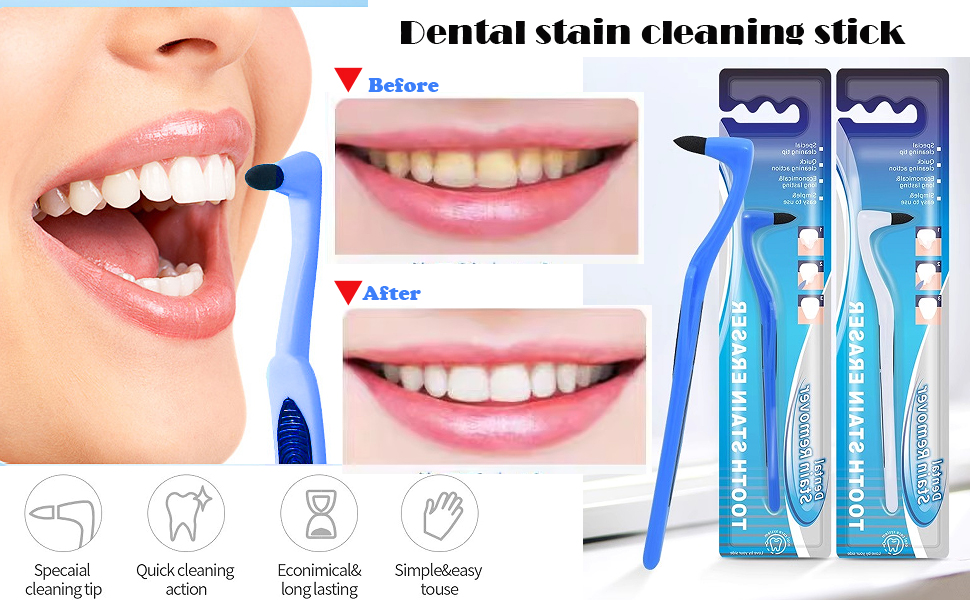 Teeth Whitening Kits