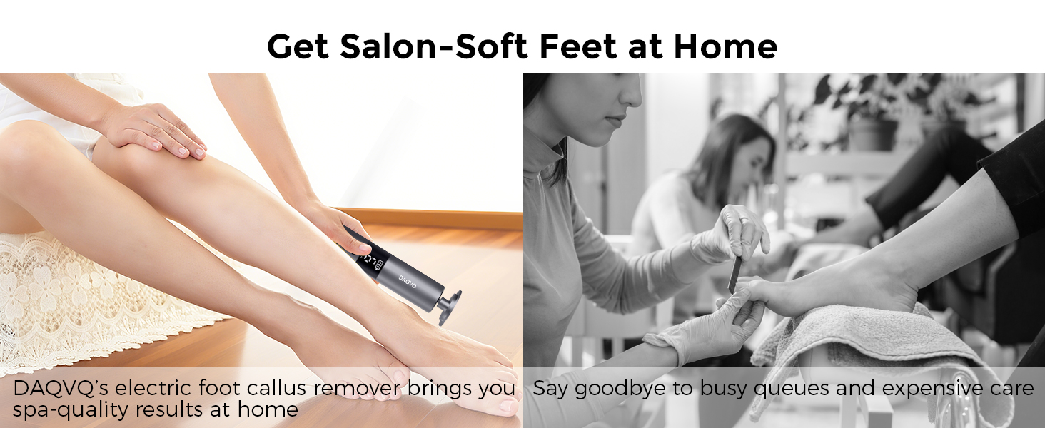callus remover for feet