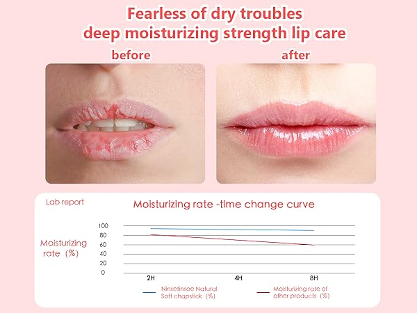 lip balms