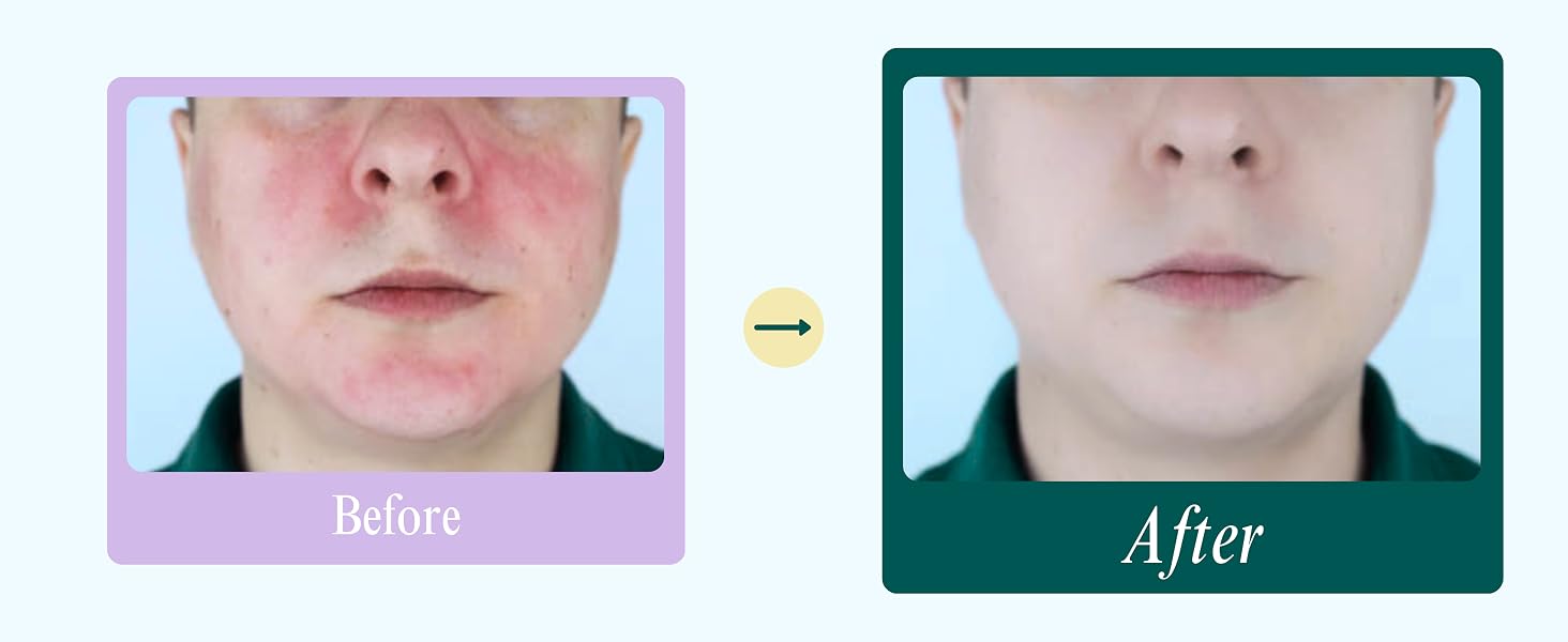 before and after 2