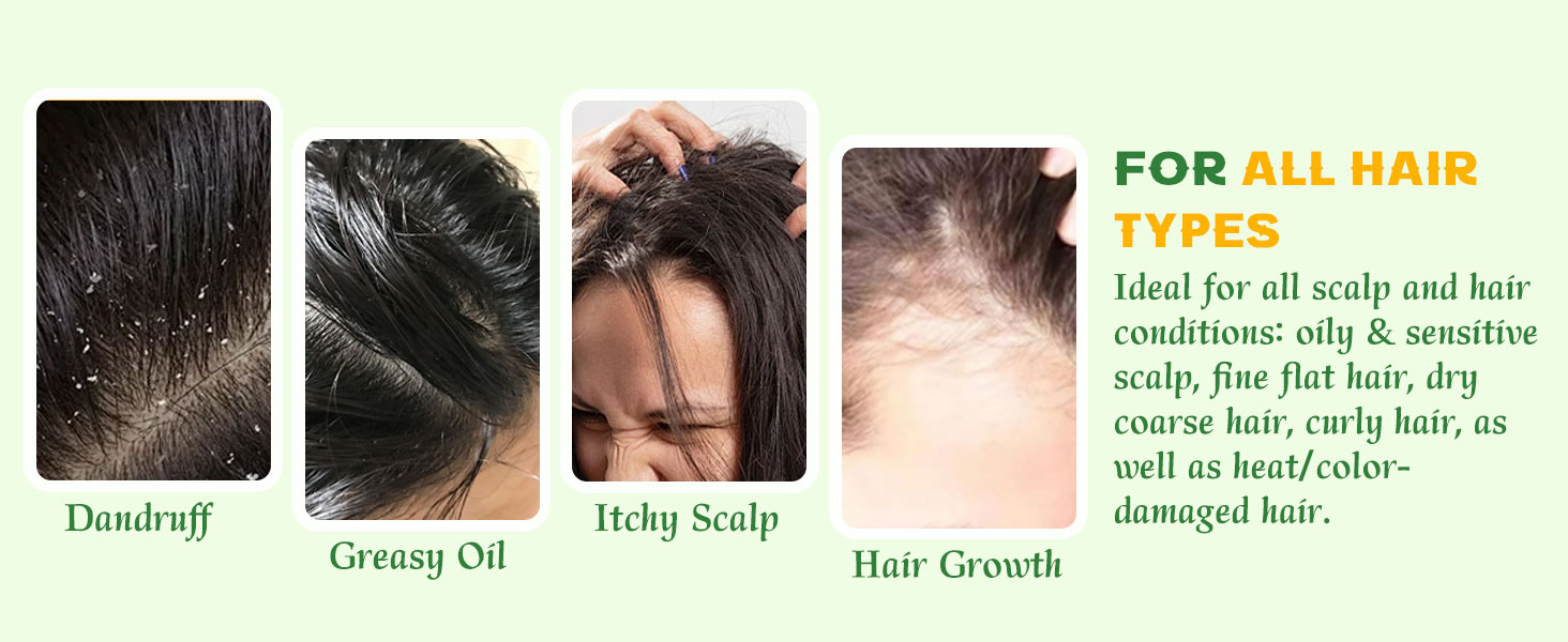 rosemary shampoo bar hair growth Oily Sensitive Itchy Thinning Dandruff Prone Scalp travel size