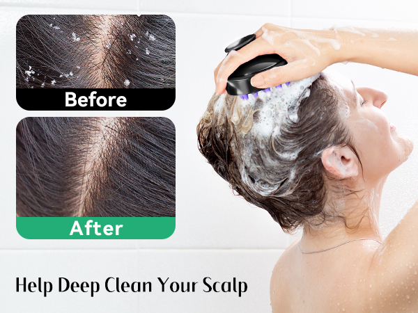scalp massager