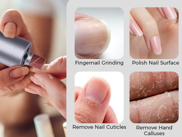 electric foot callus remover