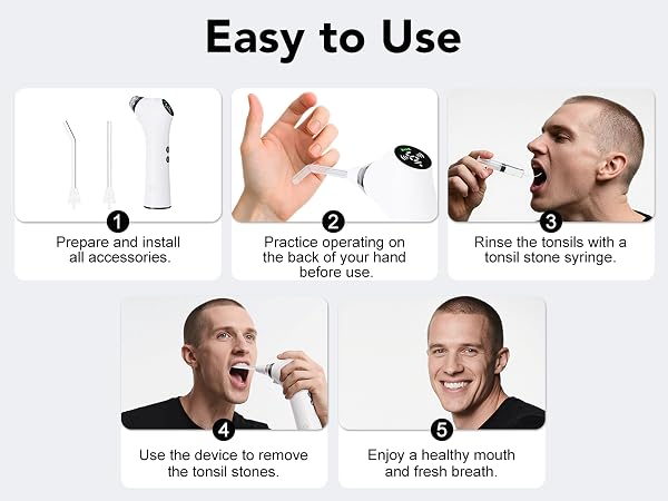 tonsil stone remover