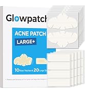 Glowpatch 10 Hydrocolloid Nose Patches + 20 XL Pimple Strips Combo, Large Acne Stickers for Face ...