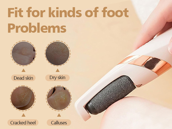 Text reads 'Fit for kinds of foot Problems' with four circular images showing different foot conditions: Dead skin, Dry skin, Cracked heel, Callous.