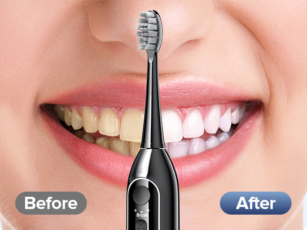 electric toothbrush with water flosser