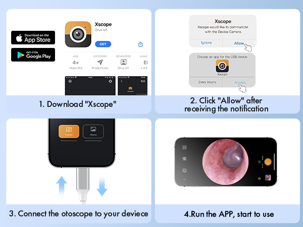 Otoscope