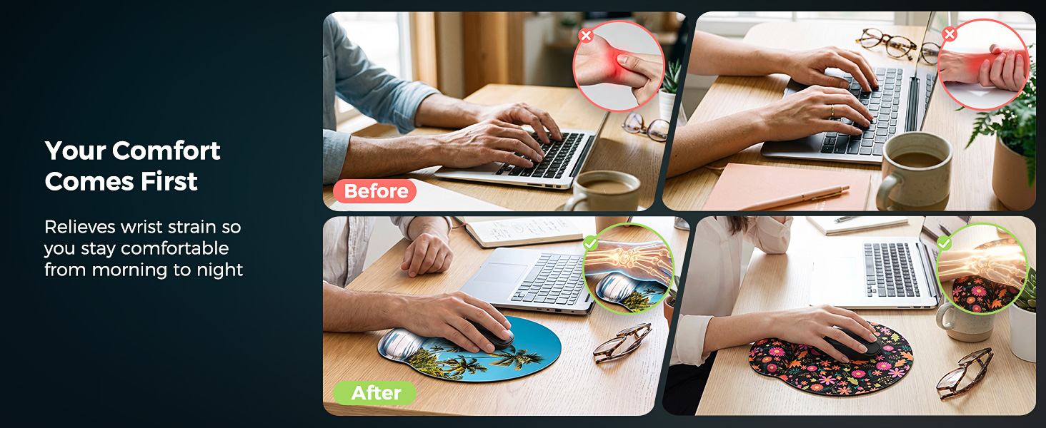 Before&amp;amp;After