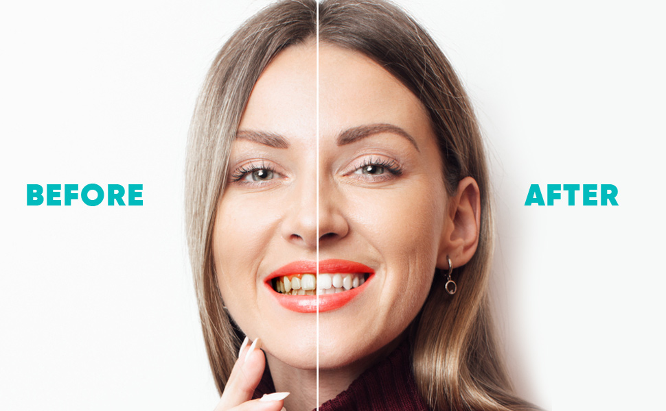 plaque remover for teeth