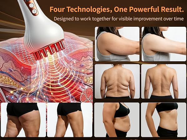 lymphatic drainage