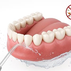 Medical diagram sequence showing denture placement process in a mouth model, demonstrating proper insertion and fitting steps.