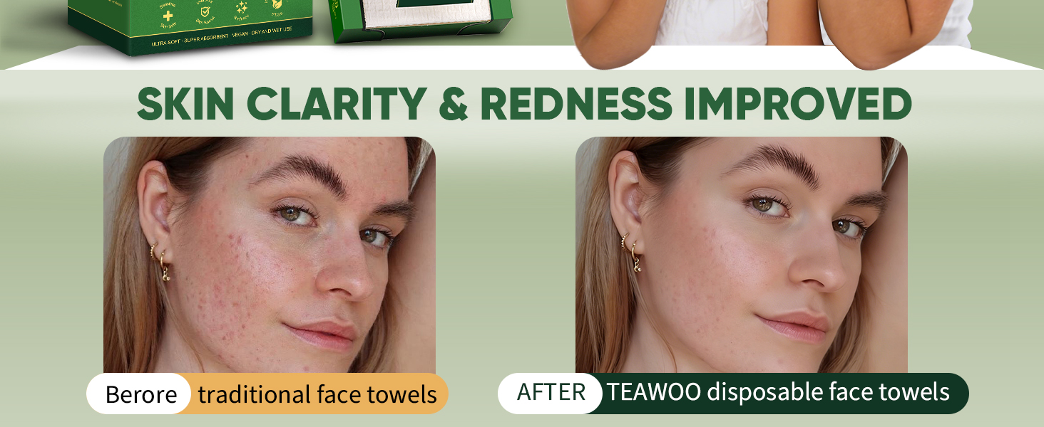 SKIN CLARITY &amp;amp; REDNESS IMPROVED