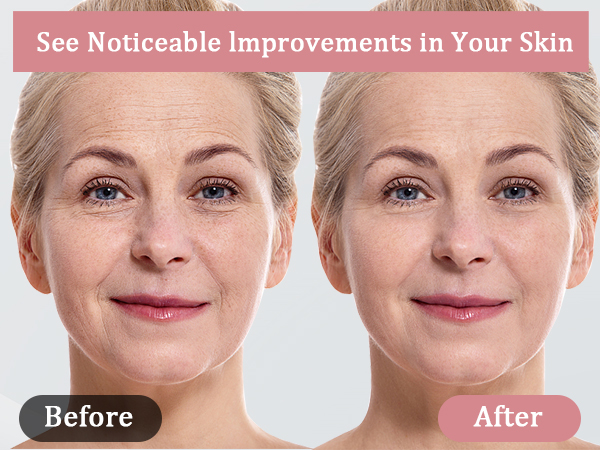 red light face massager