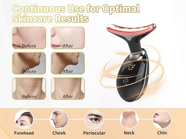 Face Light Therapy Device