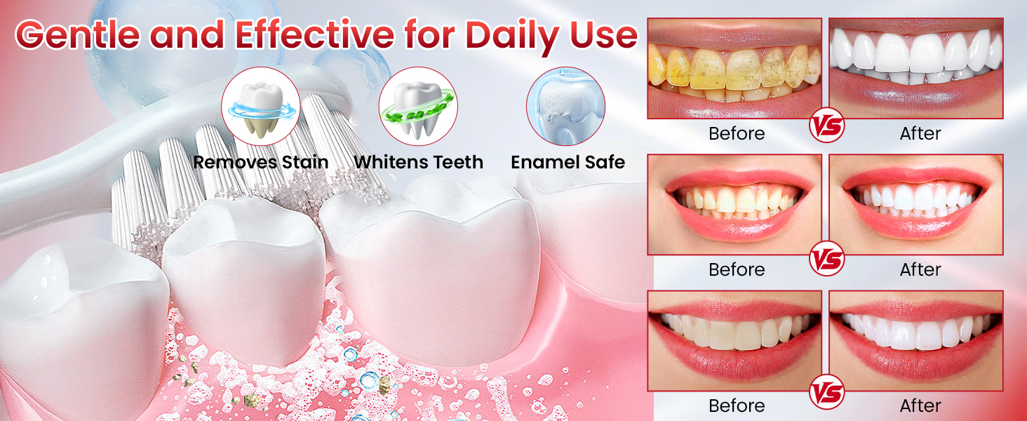 SP-6 Probiotic Brightening Toothpaste sp6 probiotic toothpaste whitening sp-6 probiotics whitening