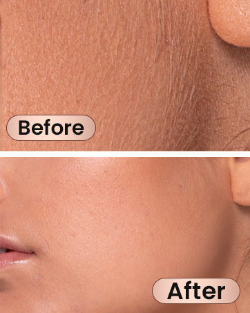 Split image comparing skin texture. Top shows rough, lined skin labeled 'Before'. Bottom shows smoother, more even-toned skin labeled 'After', demonstrating skincare product results.