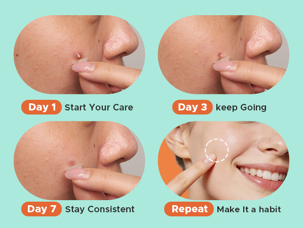 Text reads 'Day 1 Start Your Care,' 'Day 3 Keep Going,' 'Day 7 Stay Consistent,' 'Repeat Make it a habit.' Four-panel image showing skincare application progression on skin with hand demonstration of product use sequence.