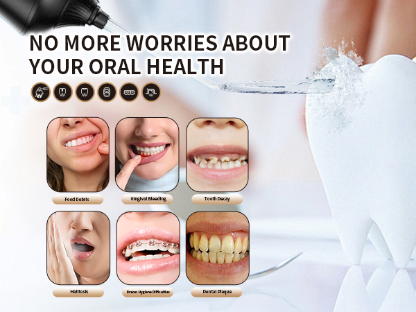 No More Worries About Your Oral Health