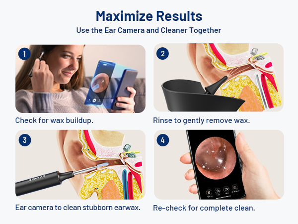 ear wax removal tool camera