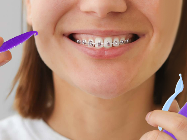 6-in-1 Orthodontic Oral Care Kit with Case