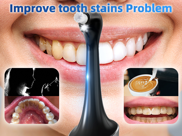 Teeth Whitening Kits