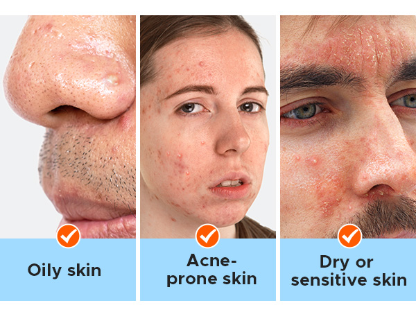 For all skin types