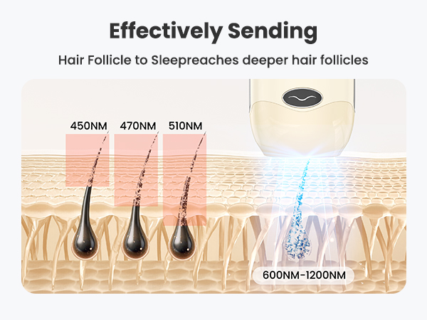 laser hair removal for women