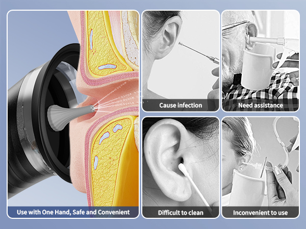 ear cleaner earwax removal