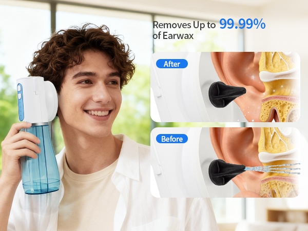 Ear Wax Removal Tool