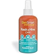 SkinSmart Antimicrobial Rash and Hive Care, 8 oz Spray Bottle